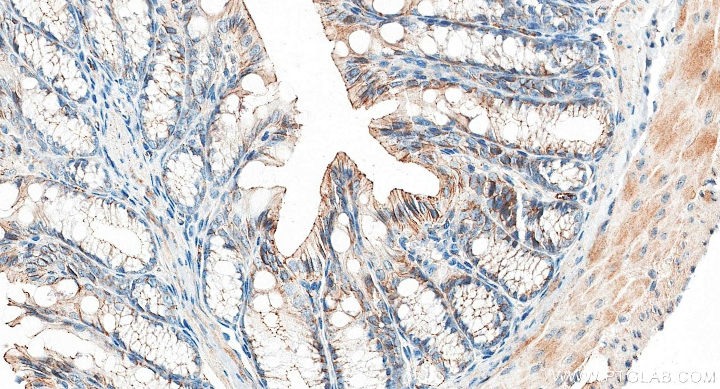 Immunohistochemistry (IHC) staining of mouse colon tissue using ZO-1 Polyclonal antibody (21773-1-AP)