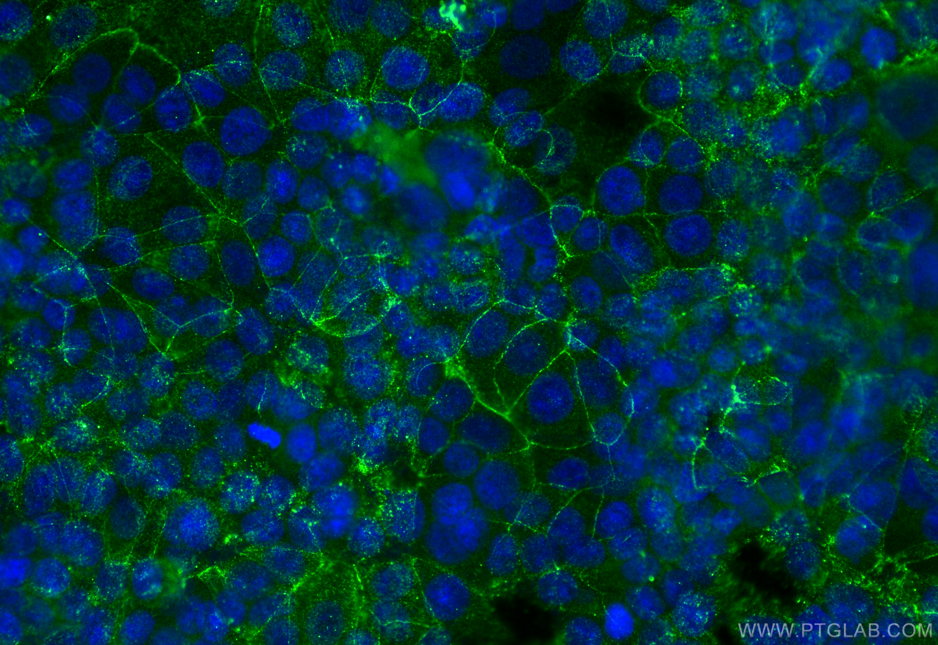 Immunofluorescence (IF) / fluorescent staining of MCF-7 cells using ZO-1 Monoclonal antibody (66452-1-Ig)