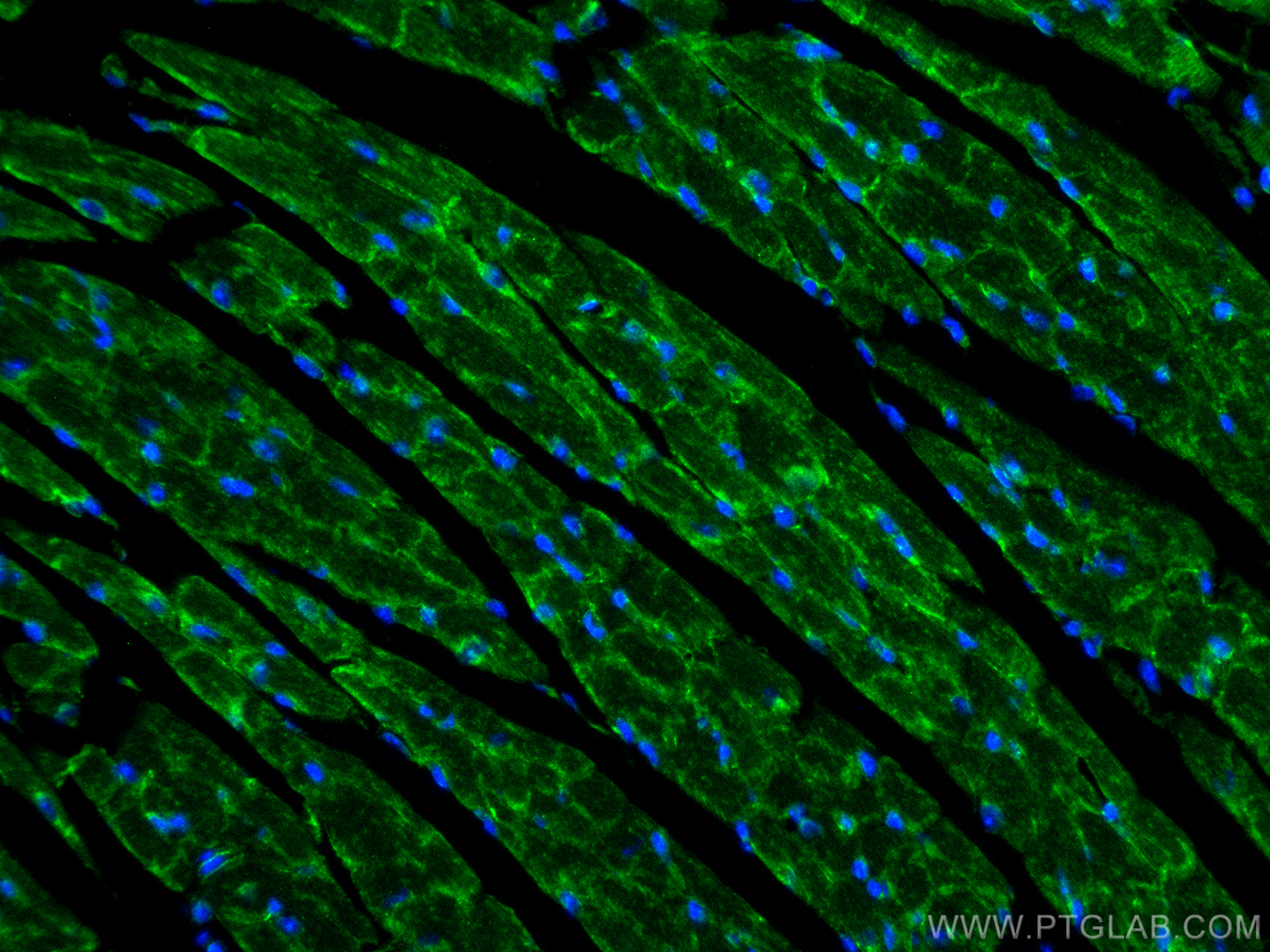 Immunofluorescence (IF) / fluorescent staining of mouse heart tissue using ZO-1 Recombinant antibody (82870-1-RR)