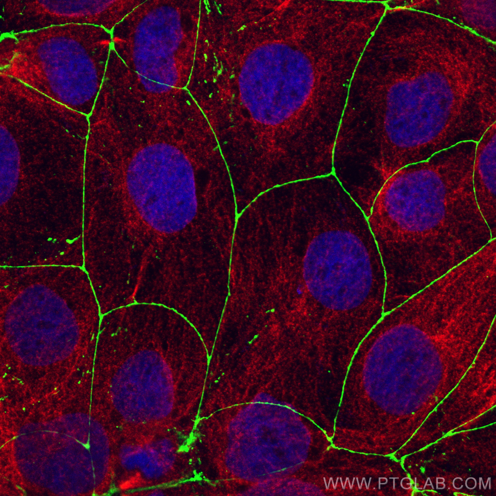 Immunofluorescence (IF) / fluorescent staining of Caco-2 cells using ZO-1 Recombinant antibody (82870-7-RR)