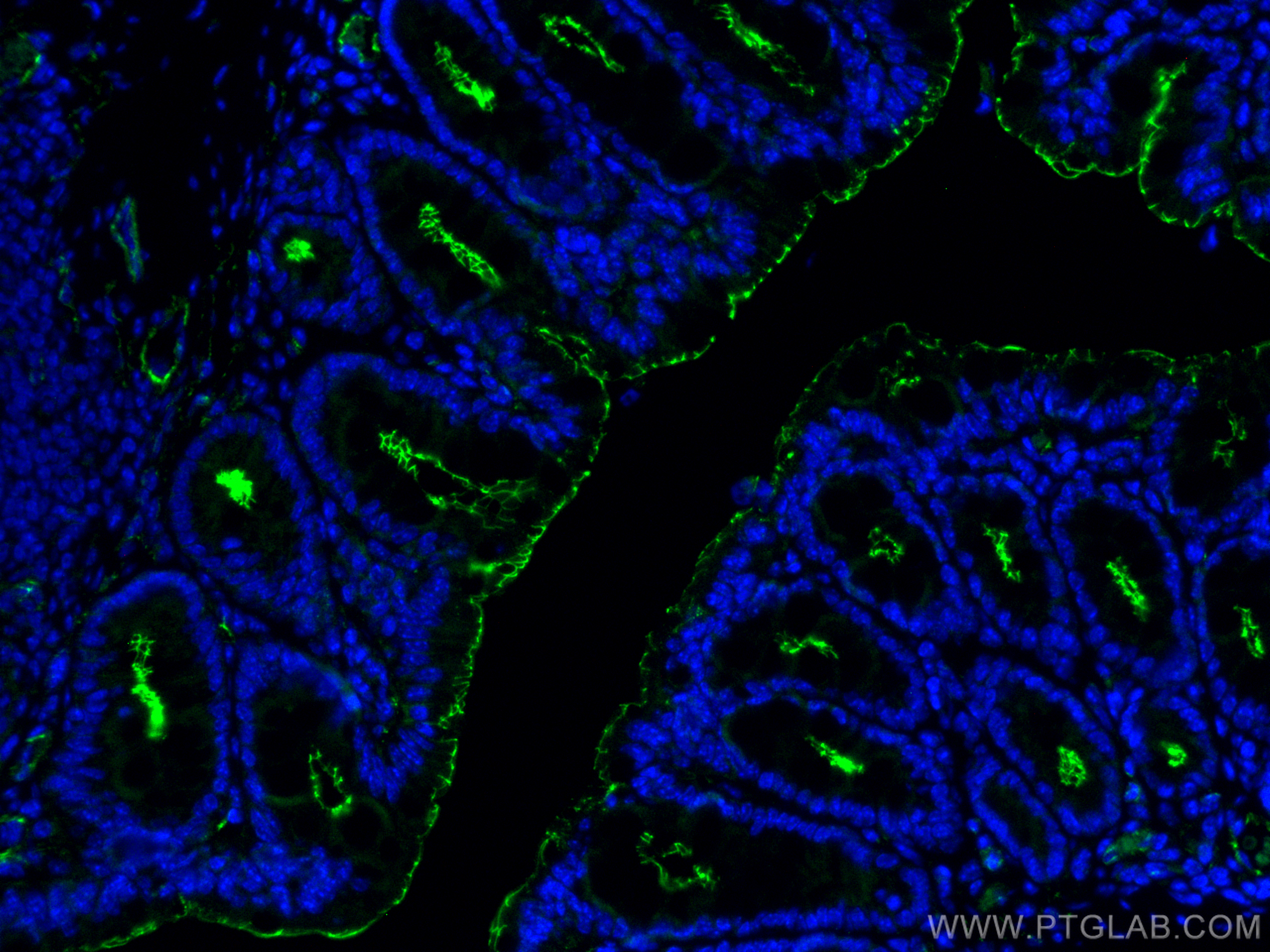 Immunofluorescence (IF) / fluorescent staining of mouse colon tissue using ZO-1 Recombinant antibody (82870-7-RR)