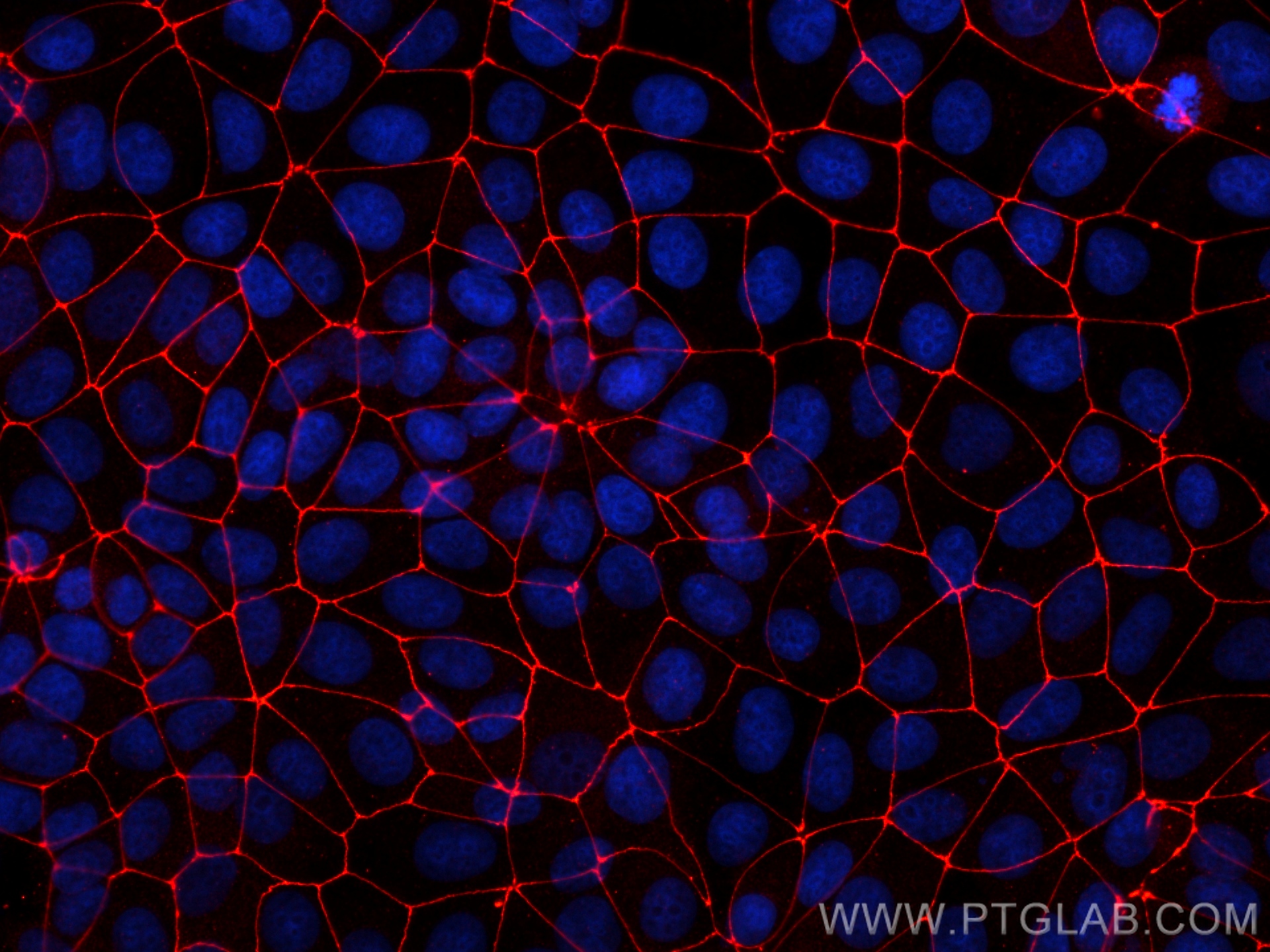 Immunofluorescence (IF) / fluorescent staining of MCF-7 cells using ZO-1 Recombinant antibody (82870-7-RR)