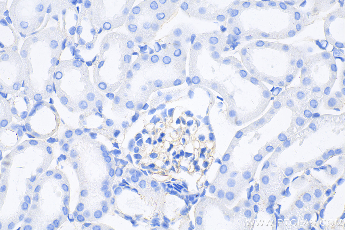 Immunohistochemistry (IHC) staining of mouse kidney tissue using ZO-1 Recombinant antibody (82870-7-RR)