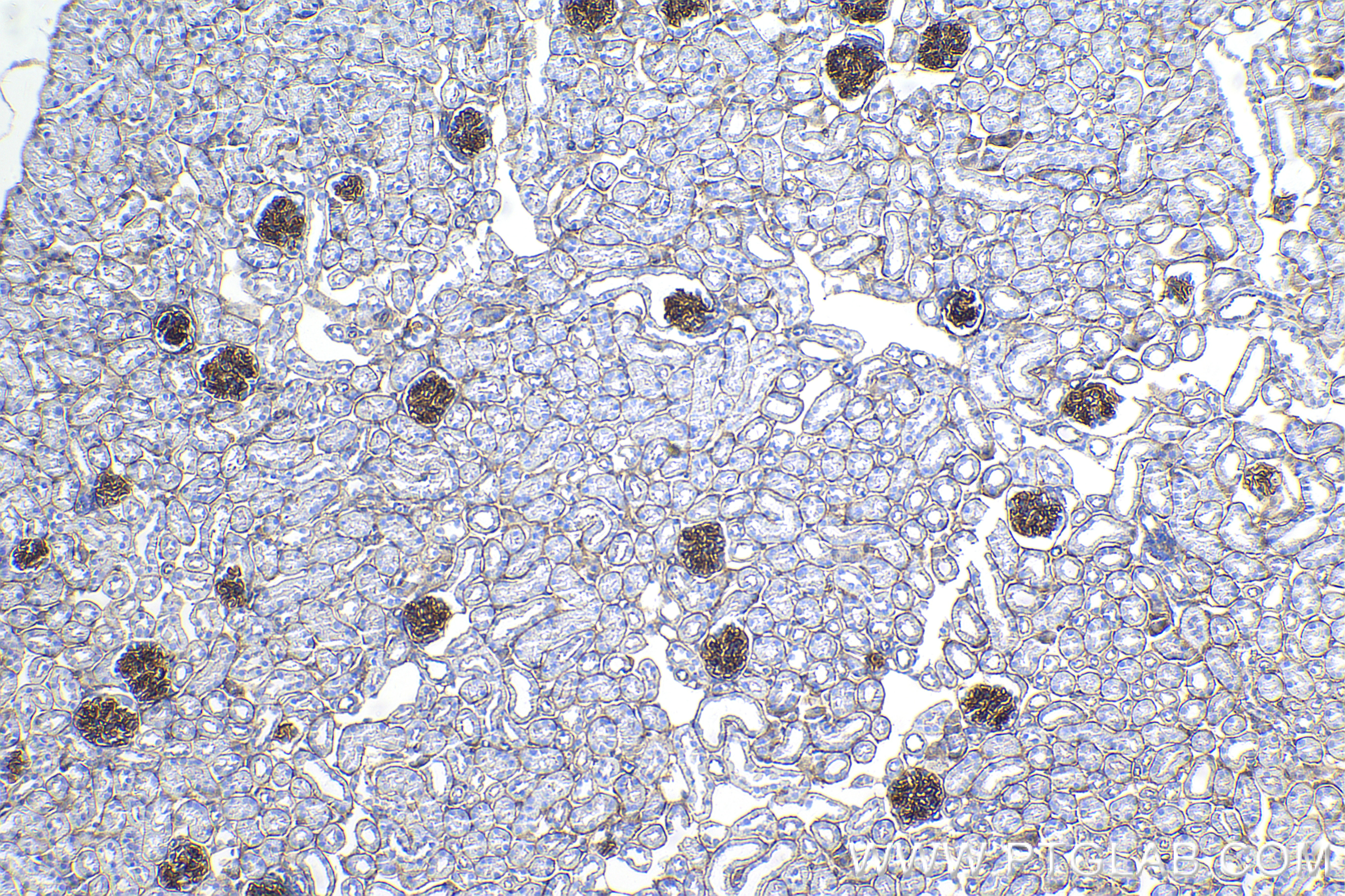 Immunohistochemistry (IHC) staining of mouse kidney tissue using ZO-1 Recombinant antibody (82870-7-RR)
