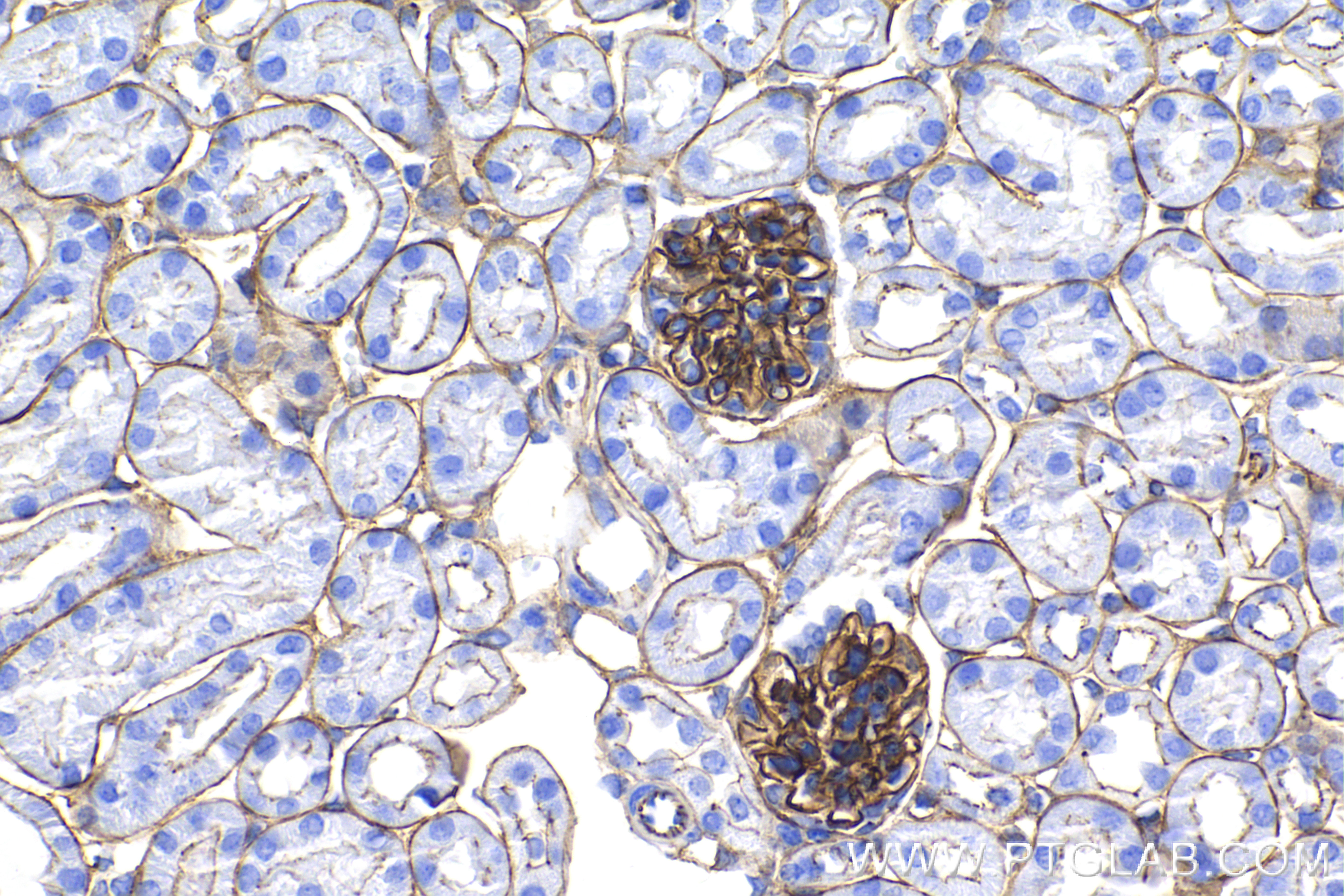 Immunohistochemistry (IHC) staining of mouse kidney tissue using ZO-1 Recombinant antibody (82870-7-RR)