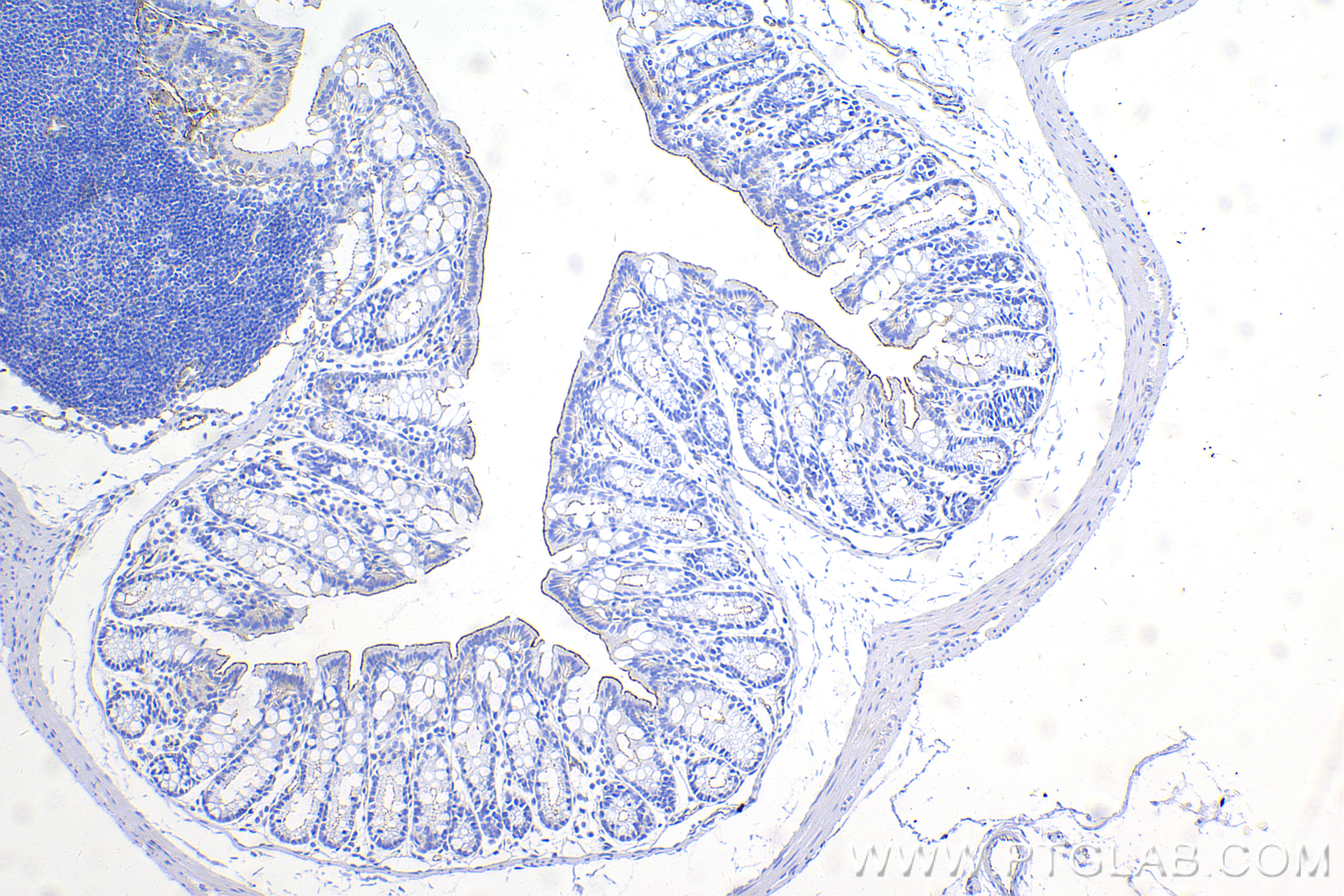 Immunohistochemistry (IHC) staining of mouse colon tissue using ZO-1 Recombinant antibody (82870-7-RR)