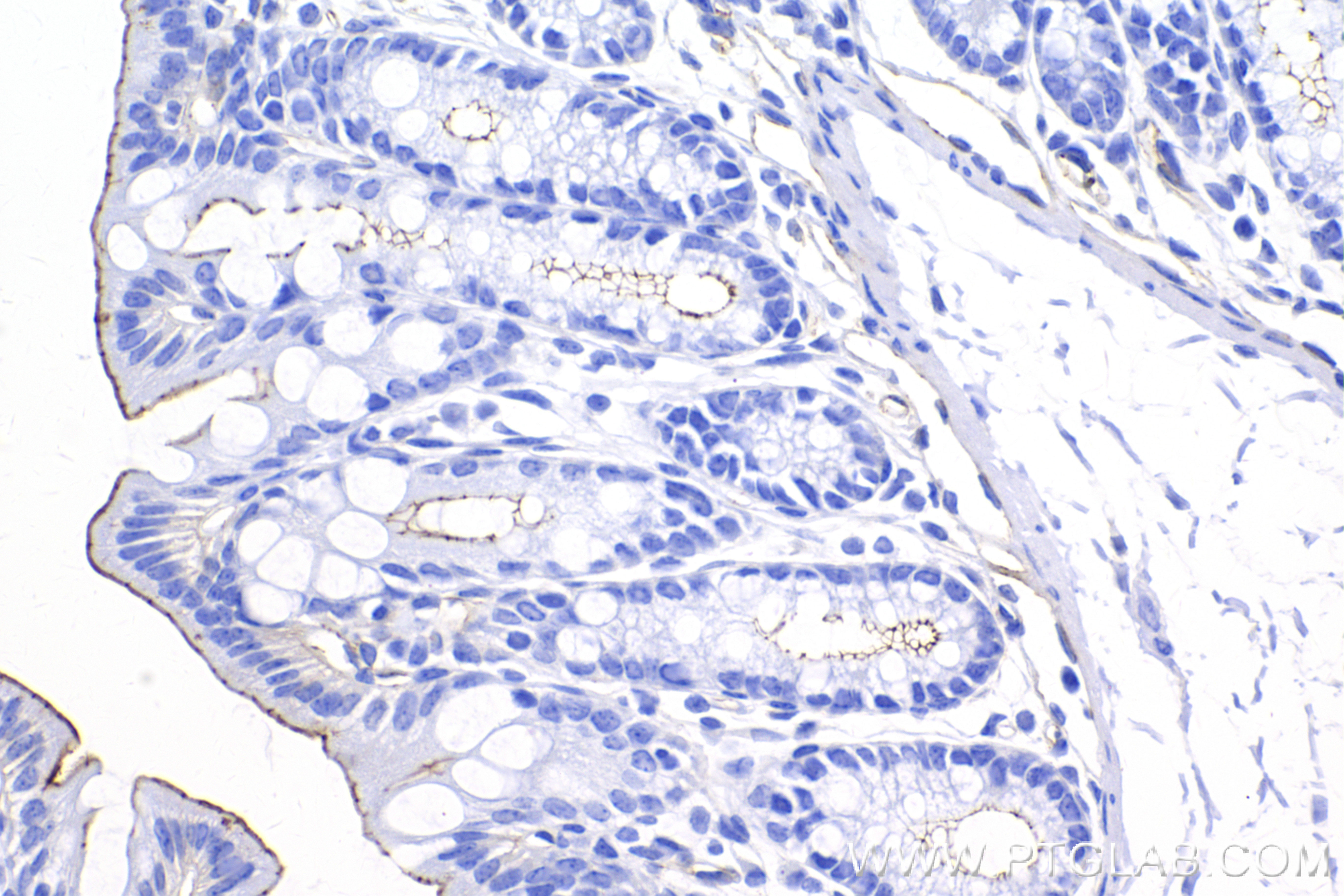 Immunohistochemistry (IHC) staining of mouse colon tissue using ZO-1 Recombinant antibody (82870-7-RR)