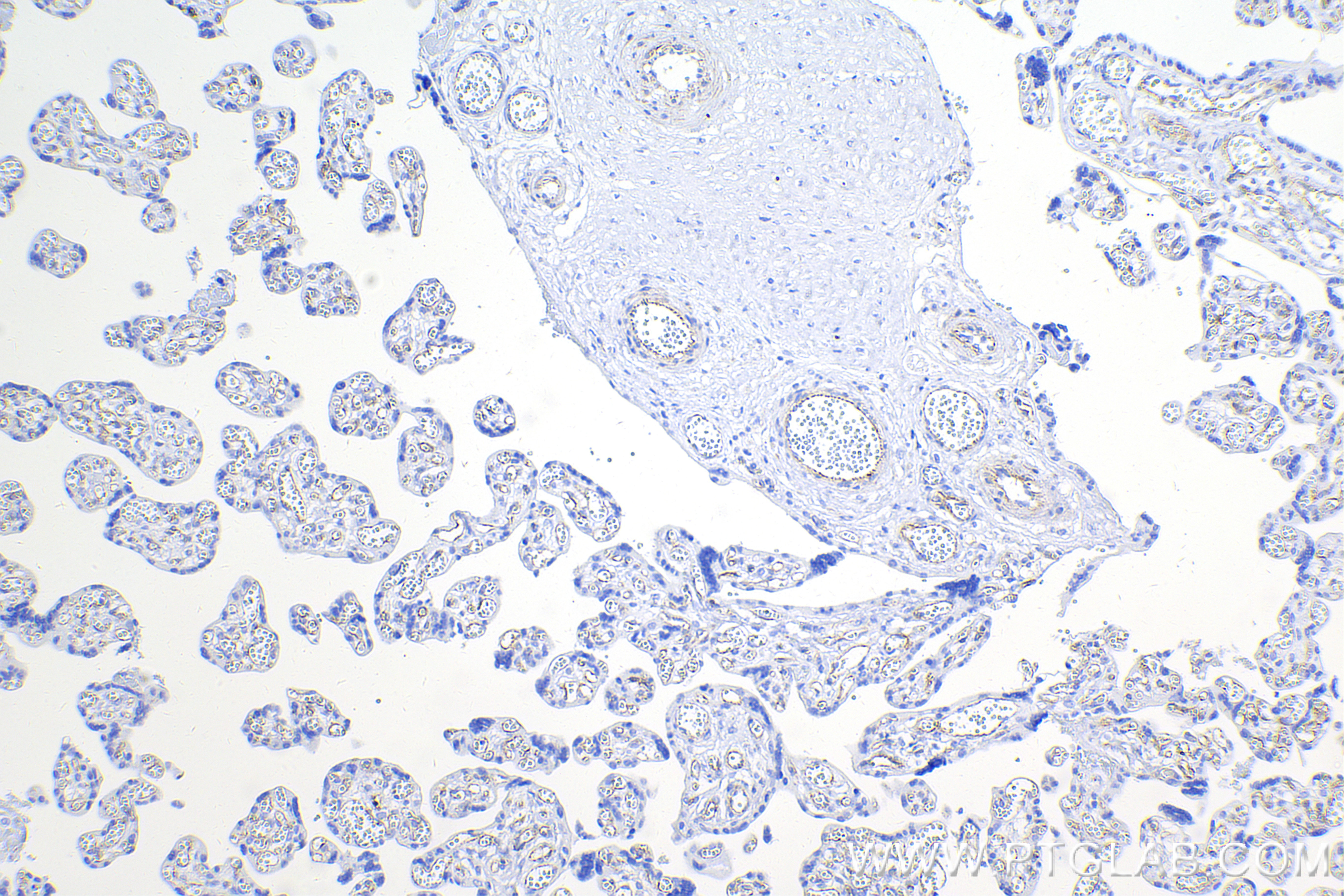 Immunohistochemistry (IHC) staining of human placenta tissue using ZO-1 Recombinant antibody (82870-7-RR)