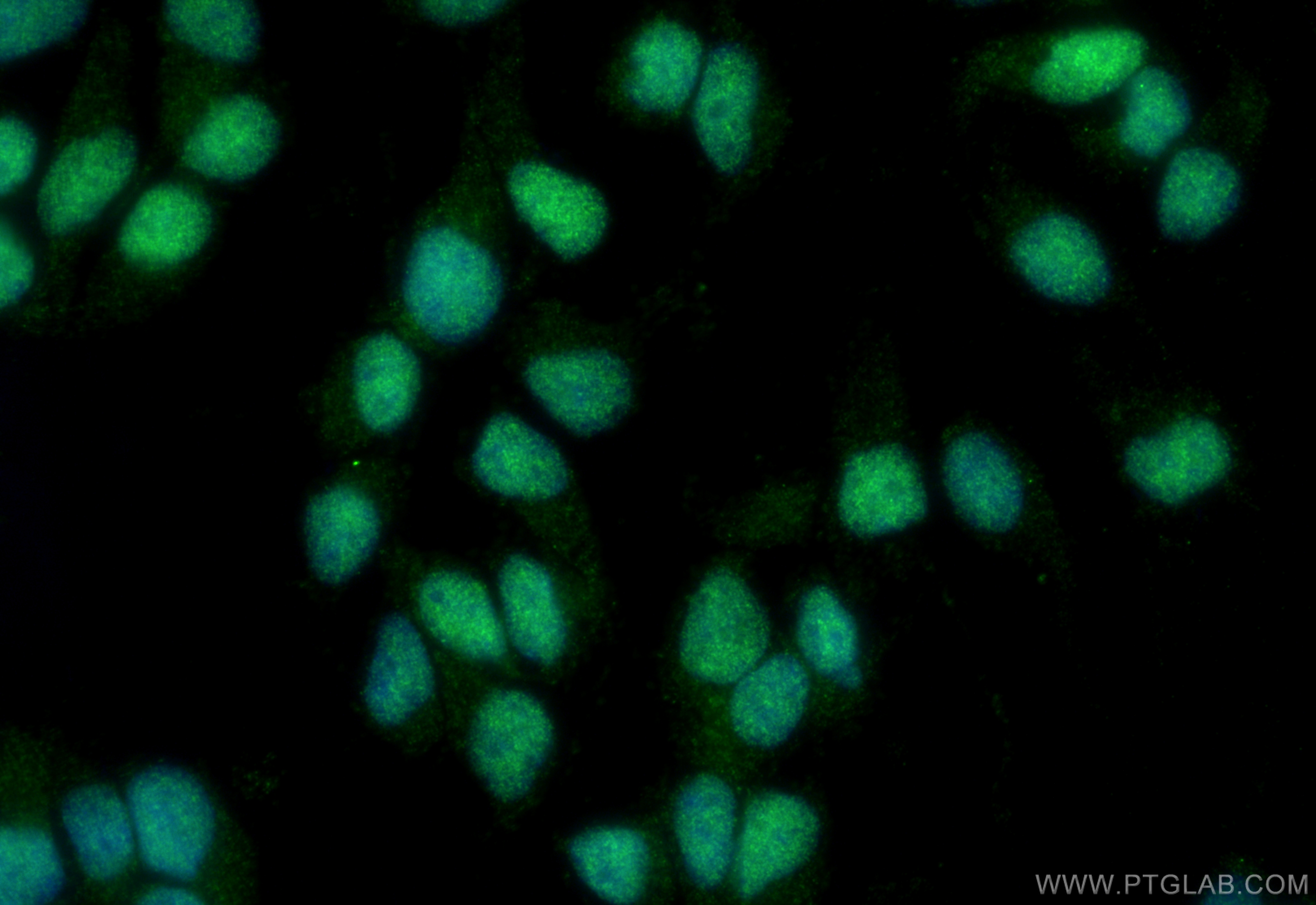 Immunofluorescence (IF) / fluorescent staining of SH-SY5Y cells using ZSCAN18 Polyclonal antibody (30704-1-AP)