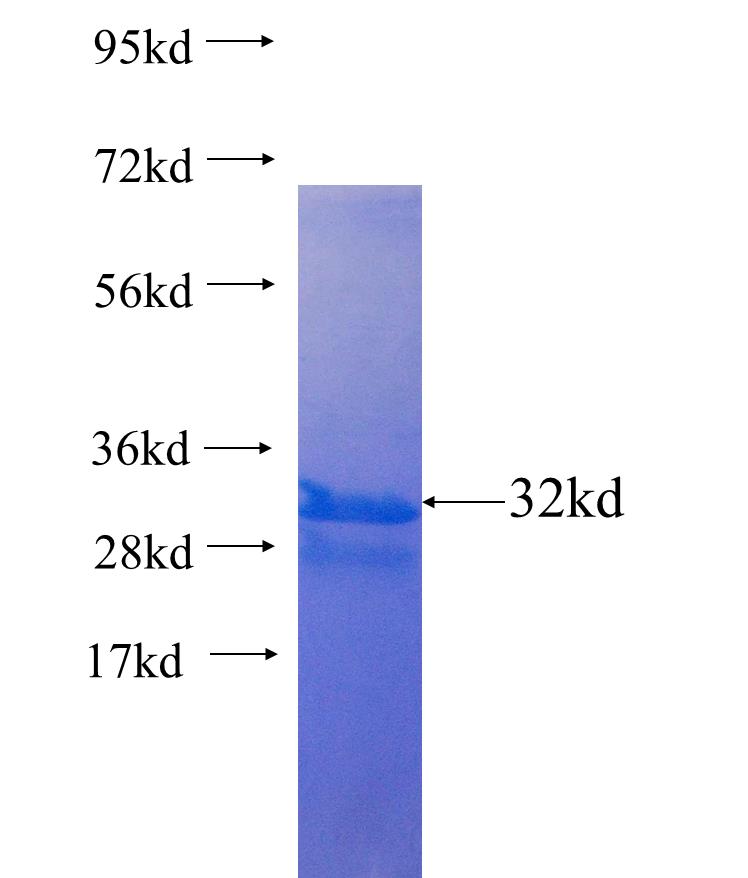 ZSCAN18 fusion protein Ag25543 SDS-PAGE