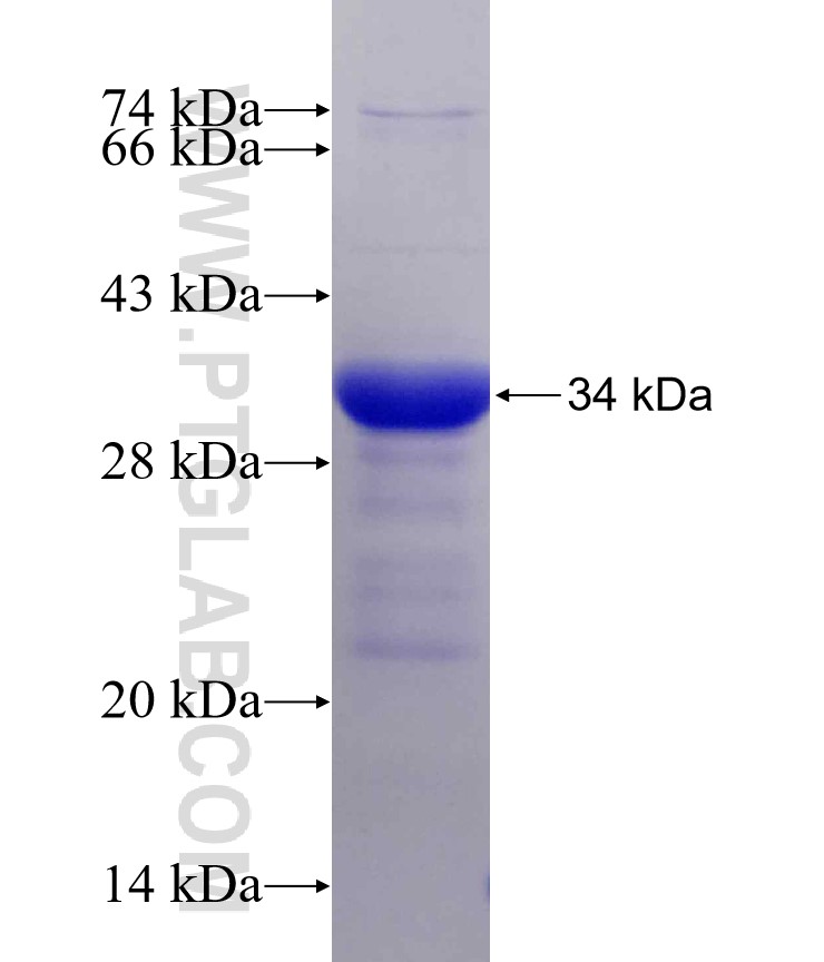 ZSCAN4 fusion protein Ag22416 SDS-PAGE