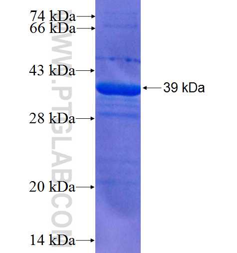 ZWILCH fusion protein Ag5941 SDS-PAGE