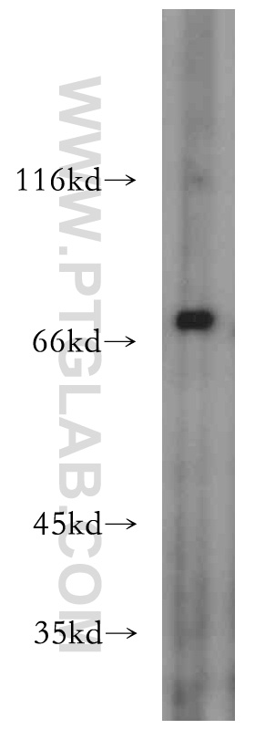 Western Blot (WB) analysis of HEK-293 cells using ZXDC Polyclonal antibody (20530-1-AP)