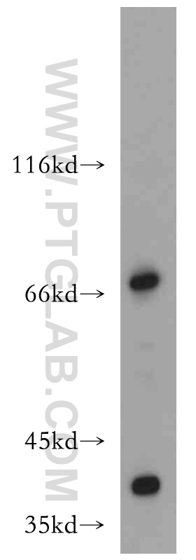 Western Blot (WB) analysis of A431 cells using ZXDC Polyclonal antibody (20530-1-AP)