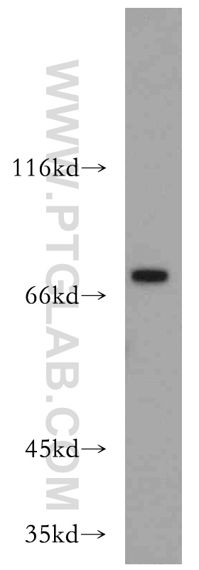 Western Blot (WB) analysis of human kidney tissue using ZXDC Polyclonal antibody (20530-1-AP)