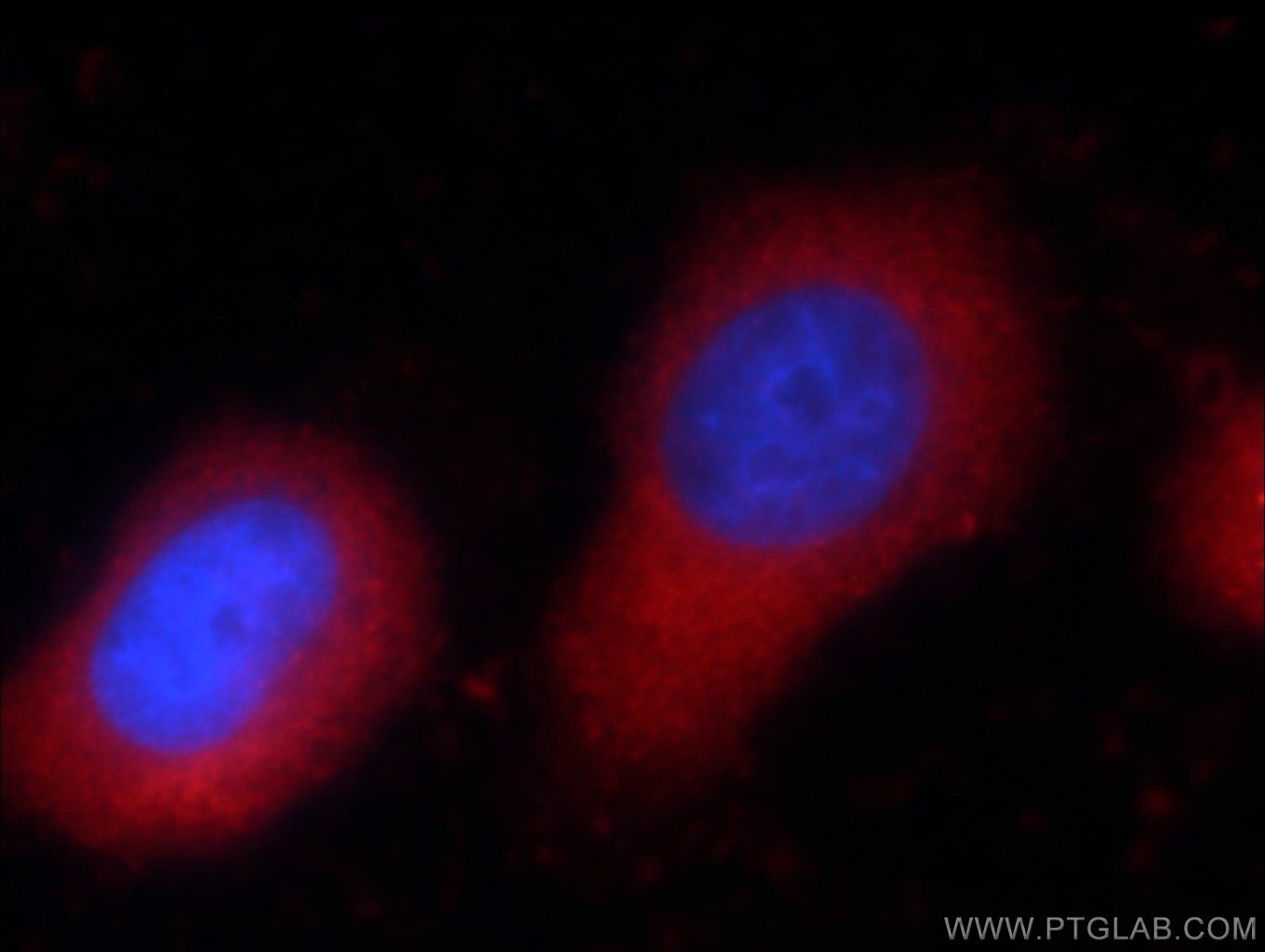 Immunofluorescence (IF) / fluorescent staining of HeLa cells using Zyxin Monoclonal antibody (60254-1-Ig)