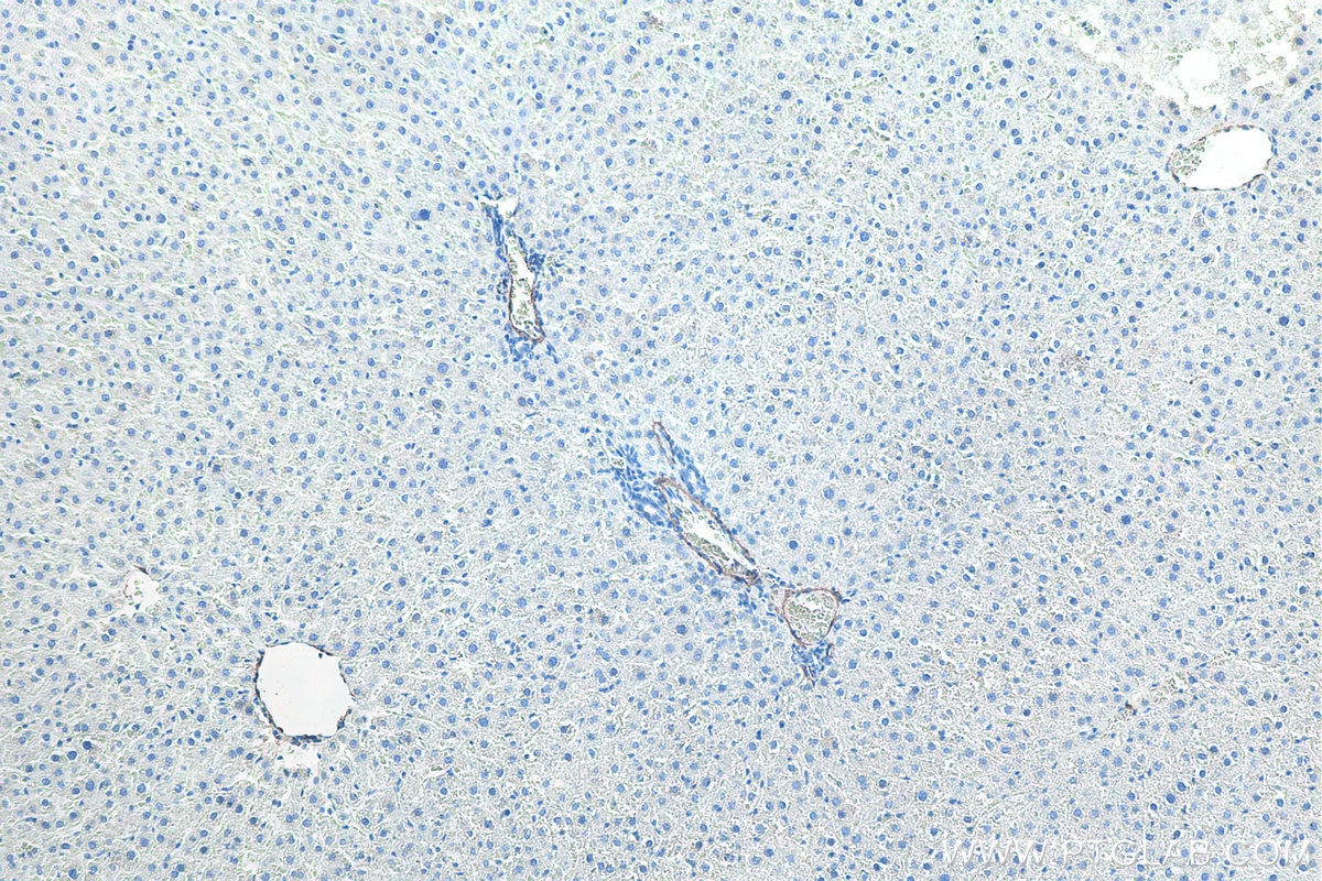 Immunohistochemistry (IHC) staining of rat liver tissue using Alpha smooth muscle actin specific Recombinant mon (80008-1-RR)