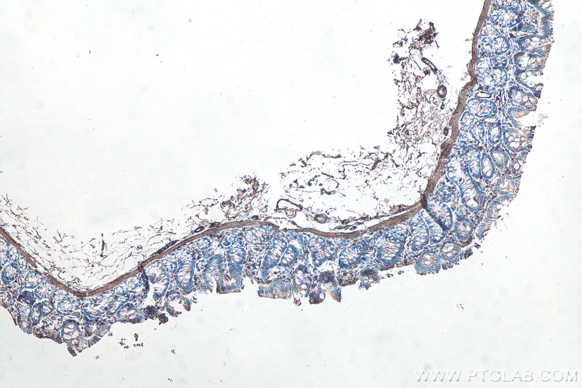 Immunohistochemistry (IHC) staining of rat colon tissue using Alpha smooth muscle actin specific Recombinant mon (80008-1-RR)