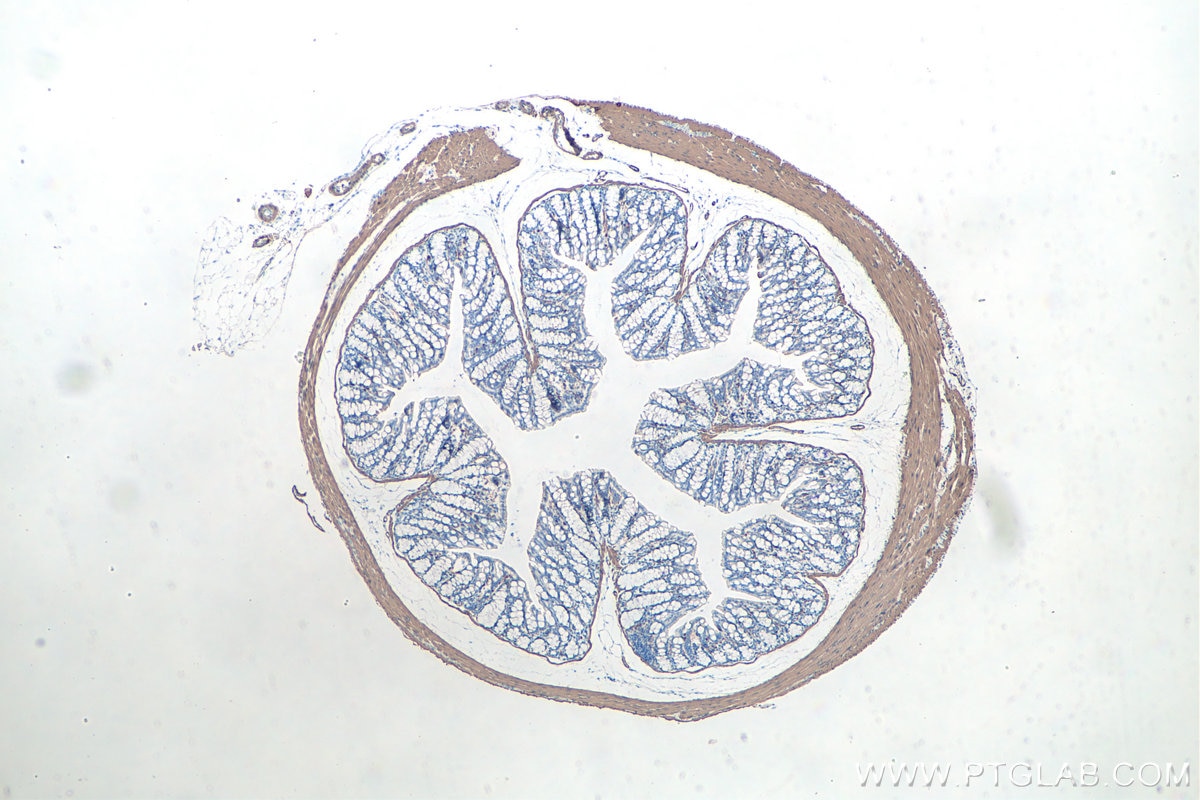 Immunohistochemistry (IHC) staining of mouse colon tissue using Alpha smooth muscle actin specific Recombinant mon (80008-1-RR)