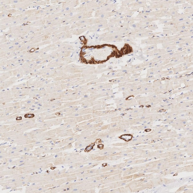 Immunohistochemistry (IHC) staining of human heart tissue using Alpha smooth muscle actin specific Recombinant mon (80008-1-RR)
