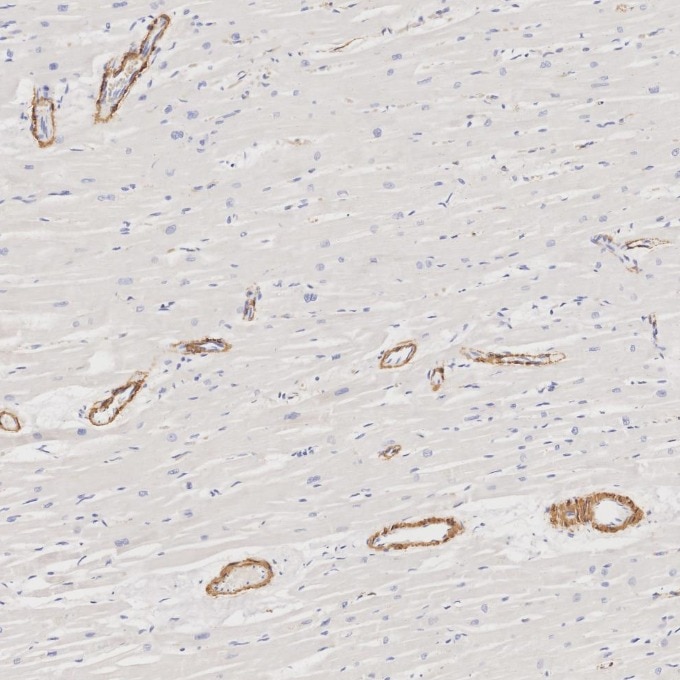Immunohistochemistry (IHC) staining of human heart tissue using Alpha smooth muscle actin specific Recombinant mon (80008-1-RR)