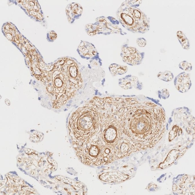 Immunohistochemistry (IHC) staining of human placenta tissue using Alpha smooth muscle actin specific Recombinant mon (80008-1-RR)