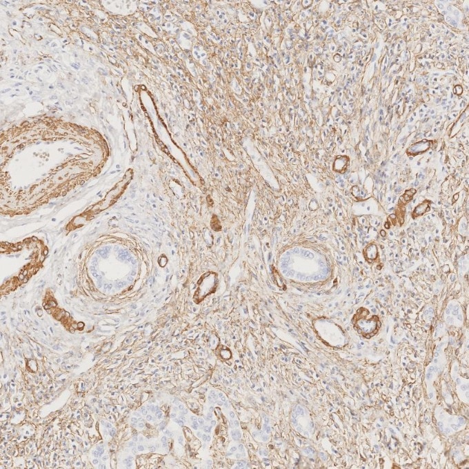 Immunohistochemistry (IHC) staining of human liver tissue using Alpha smooth muscle actin specific Recombinant mon (80008-1-RR)