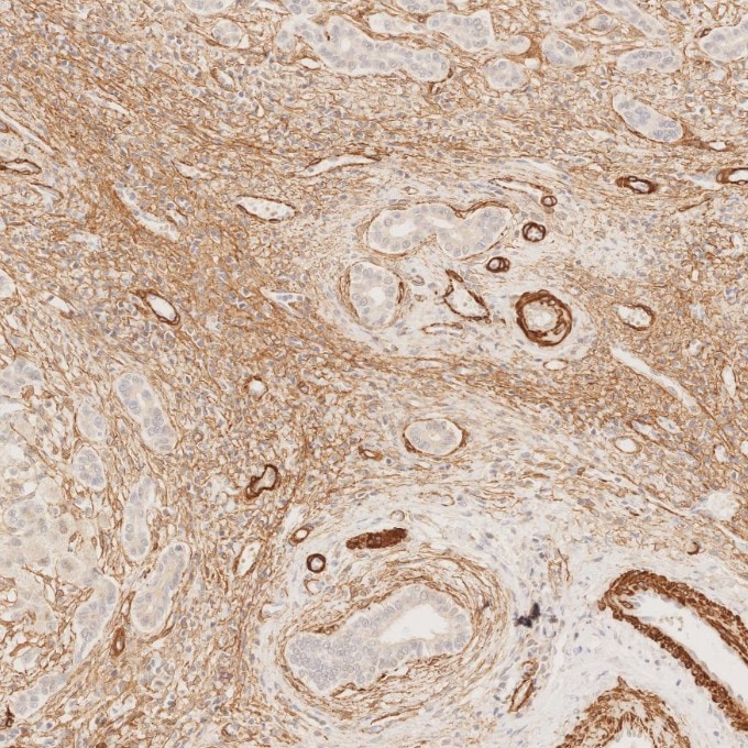 Immunohistochemistry (IHC) staining of human liver tissue using Alpha smooth muscle actin specific Recombinant mon (80008-1-RR)