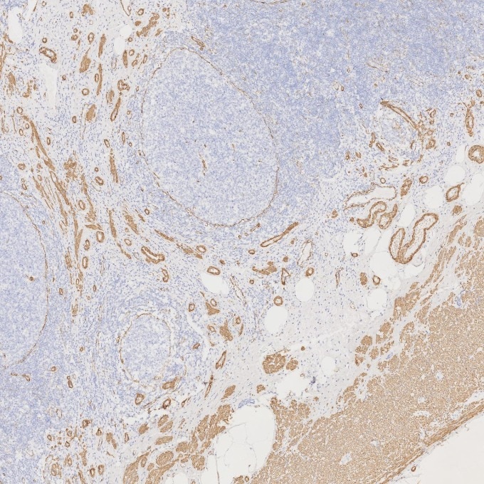 Immunohistochemistry (IHC) staining of human appendicitis tissue using Alpha smooth muscle actin specific Recombinant mon (80008-1-RR)