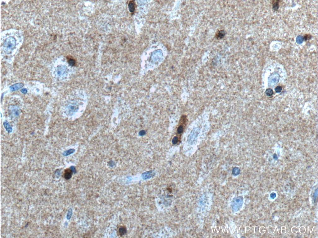 Immunohistochemistry (IHC) staining of human brain tissue using Alpha Synuclein Monoclonal antibody (66412-1-Ig)