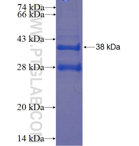 a1-antitrypsin fusion protein Ag22631 SDS-PAGE