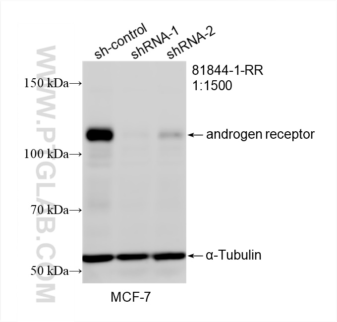 Western Blot (WB) analysis of MCF-7 cells using androgen receptor Recombinant antibody (81844-1-RR)