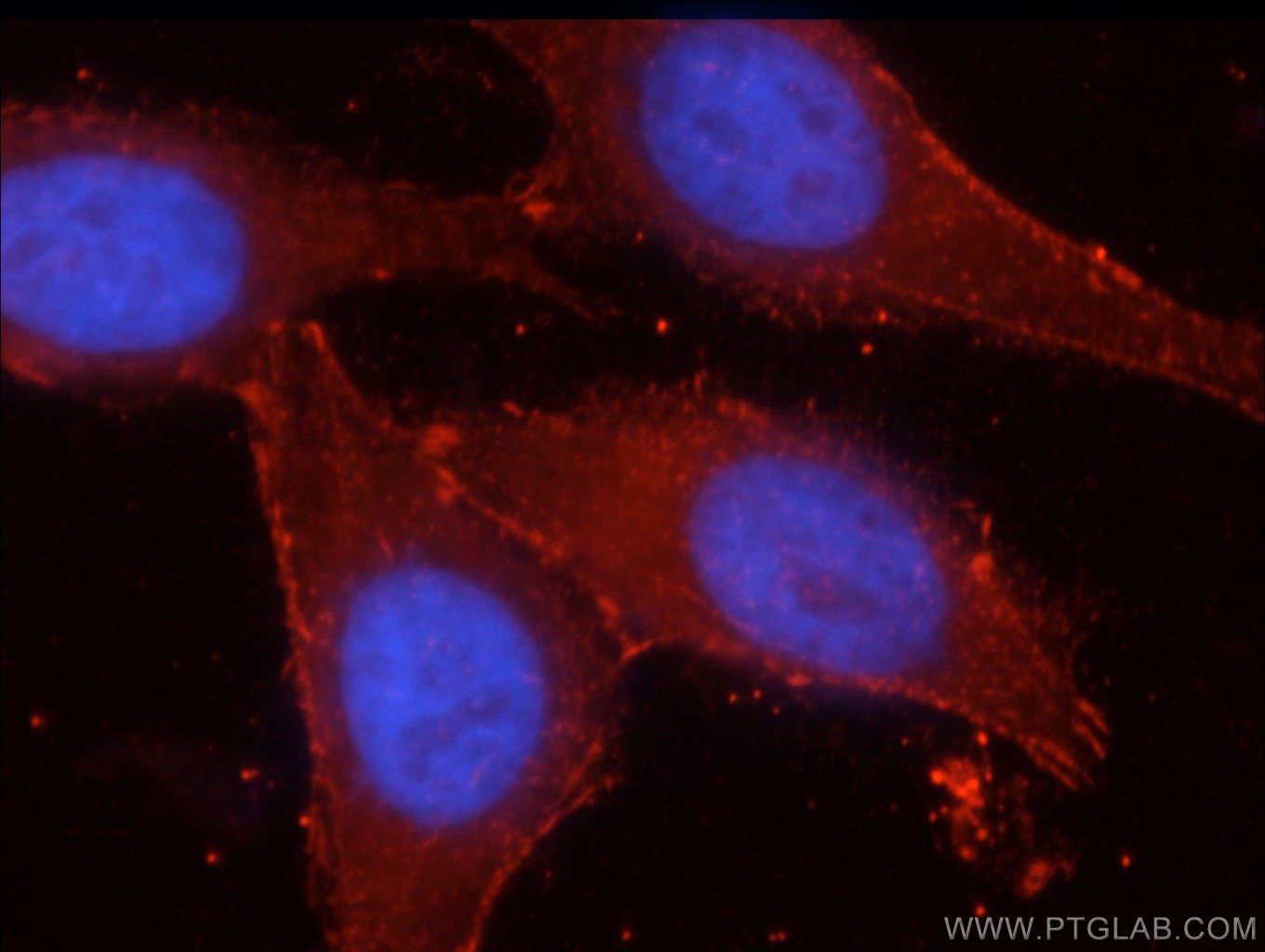 IF analysis of HepG2 cells, using CTNNB1 antibody (51067-2-AP) at a 1:50 dilution and Rhodamine-labeled goat anti-rabbit IgG (red)