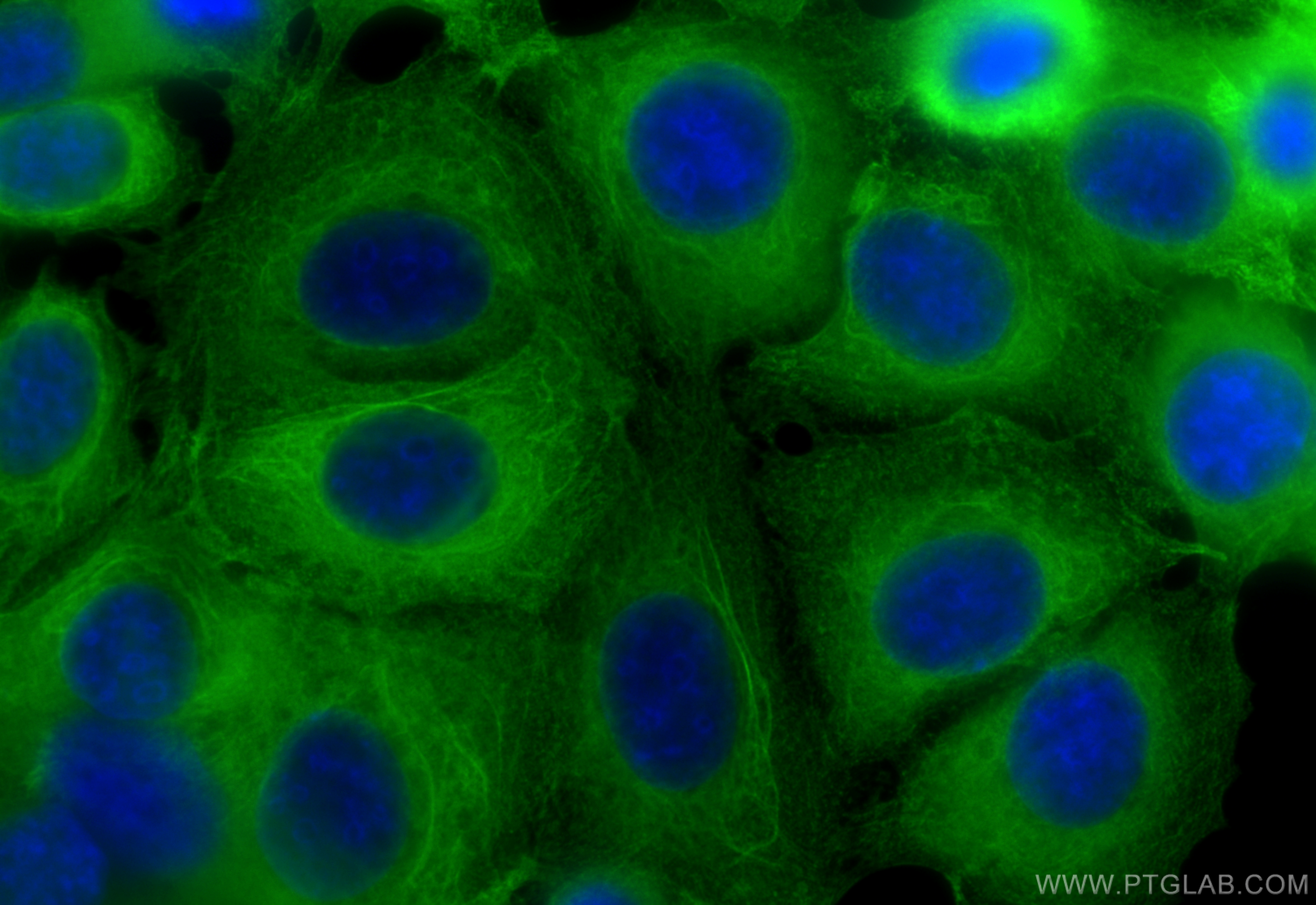 Immunofluorescence (IF) / fluorescent staining of MCF-7 cells using CoraLite® Plus 488-conjugated Beta Actin Monoclona (CL488-60008)