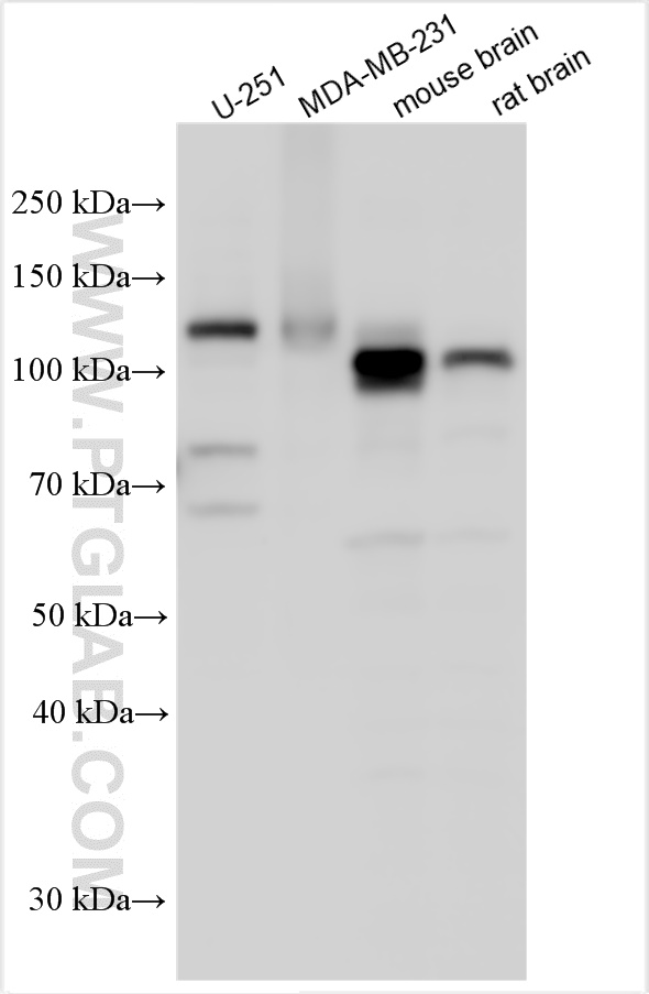 Western Blot (WB) analysis of various lysates using APP Polyclonal antibody (27320-1-AP)