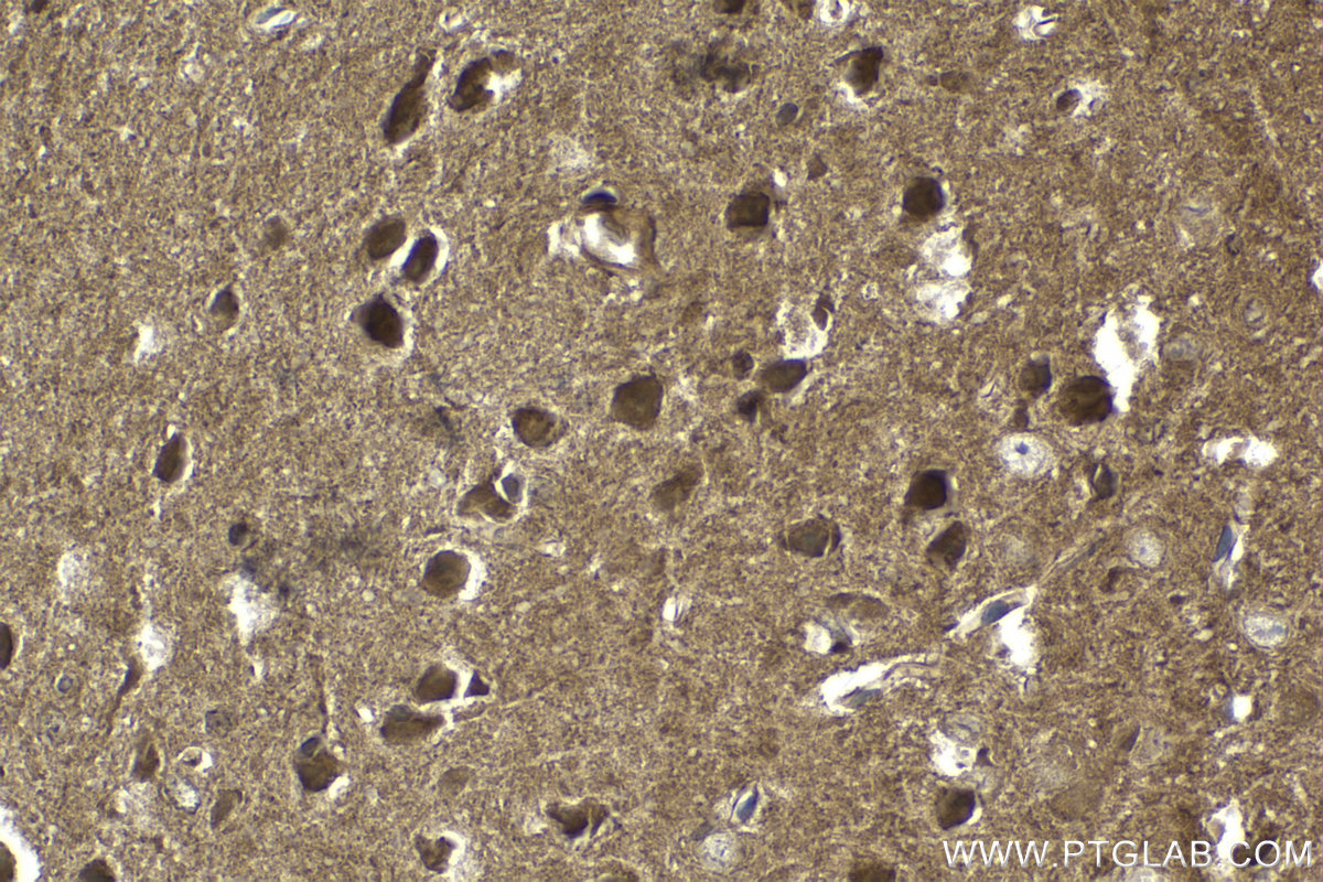 Immunohistochemistry (IHC) staining of mouse brain tissue using Beta Arrestin 1 Monoclonal antibody (67580-1-Ig)