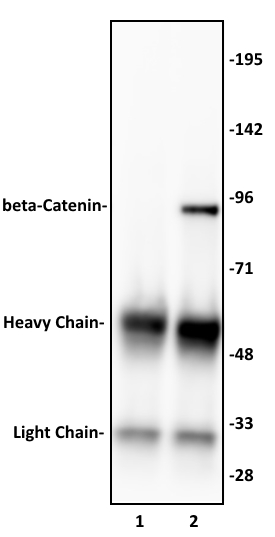 beta-Catenin antibody (pAb) tested by Immunoprecipitation. 10 ul of beta-Catenin antibody was used to immunoprecipitate beta-Catenin from 500 ug of HeLa whole cell extract (lane 2). 10 ul of rabbit IgG was used as a negative control (lane 1). The immunoprecipitated protein was detected by Western blotting using the beta-Catenin antibody at a dilution of 1:500.