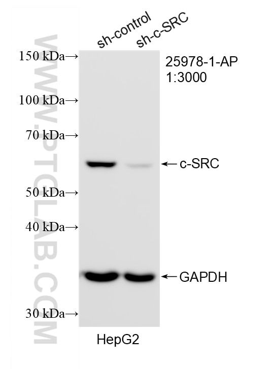 Western Blot (WB) analysis of HepG2 cells using c-SRC Polyclonal antibody (25978-1-AP)