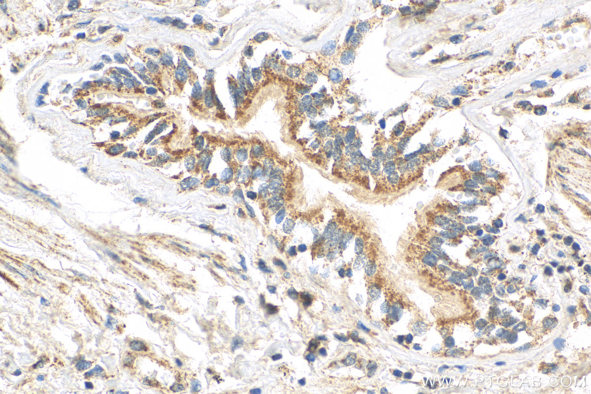 Immunohistochemistry (IHC) staining of human lung tissue using cGAS Polyclonal antibody (29958-1-AP)