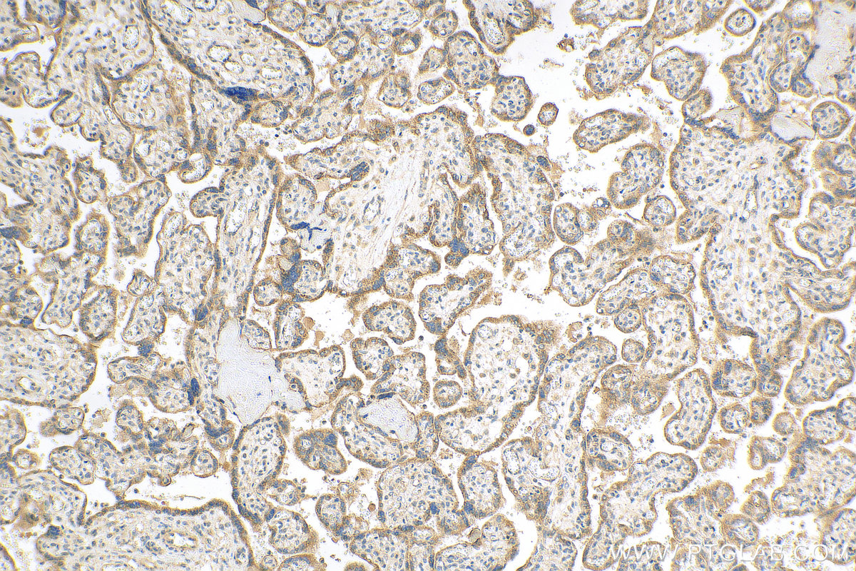 Immunohistochemistry (IHC) staining of human placenta tissue using cGAS Polyclonal antibody (29958-1-AP)