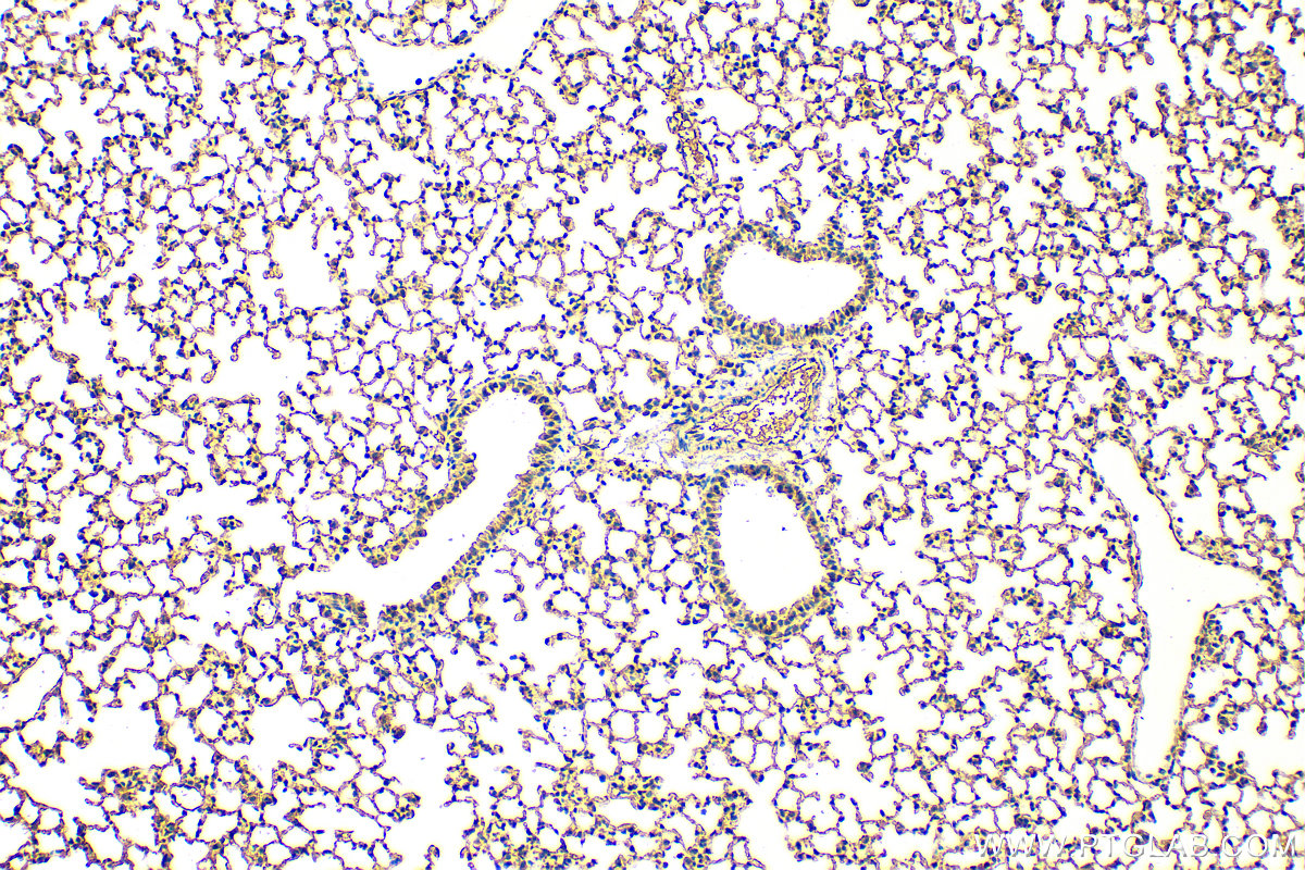Immunohistochemistry (IHC) staining of mouse lung tissue using cGAS Polyclonal antibody (29958-1-AP)