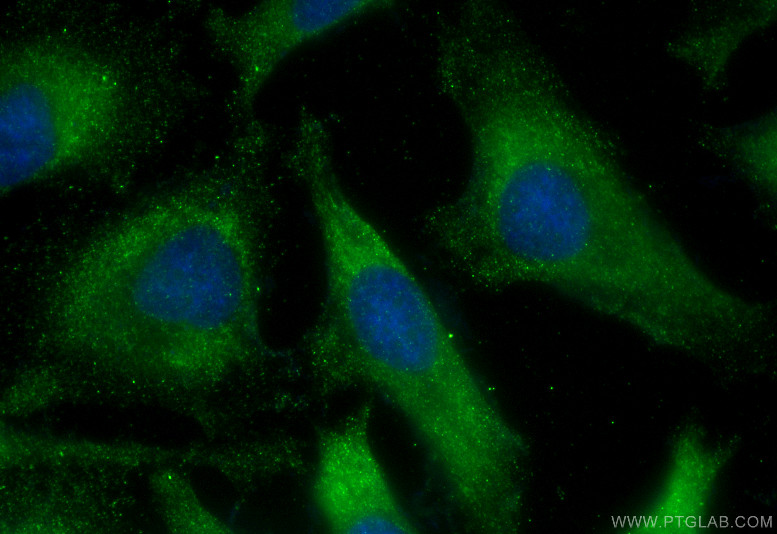 Immunofluorescence (IF) / fluorescent staining of HeLa cells using cGAS Monoclonal antibody (68640-1-Ig)