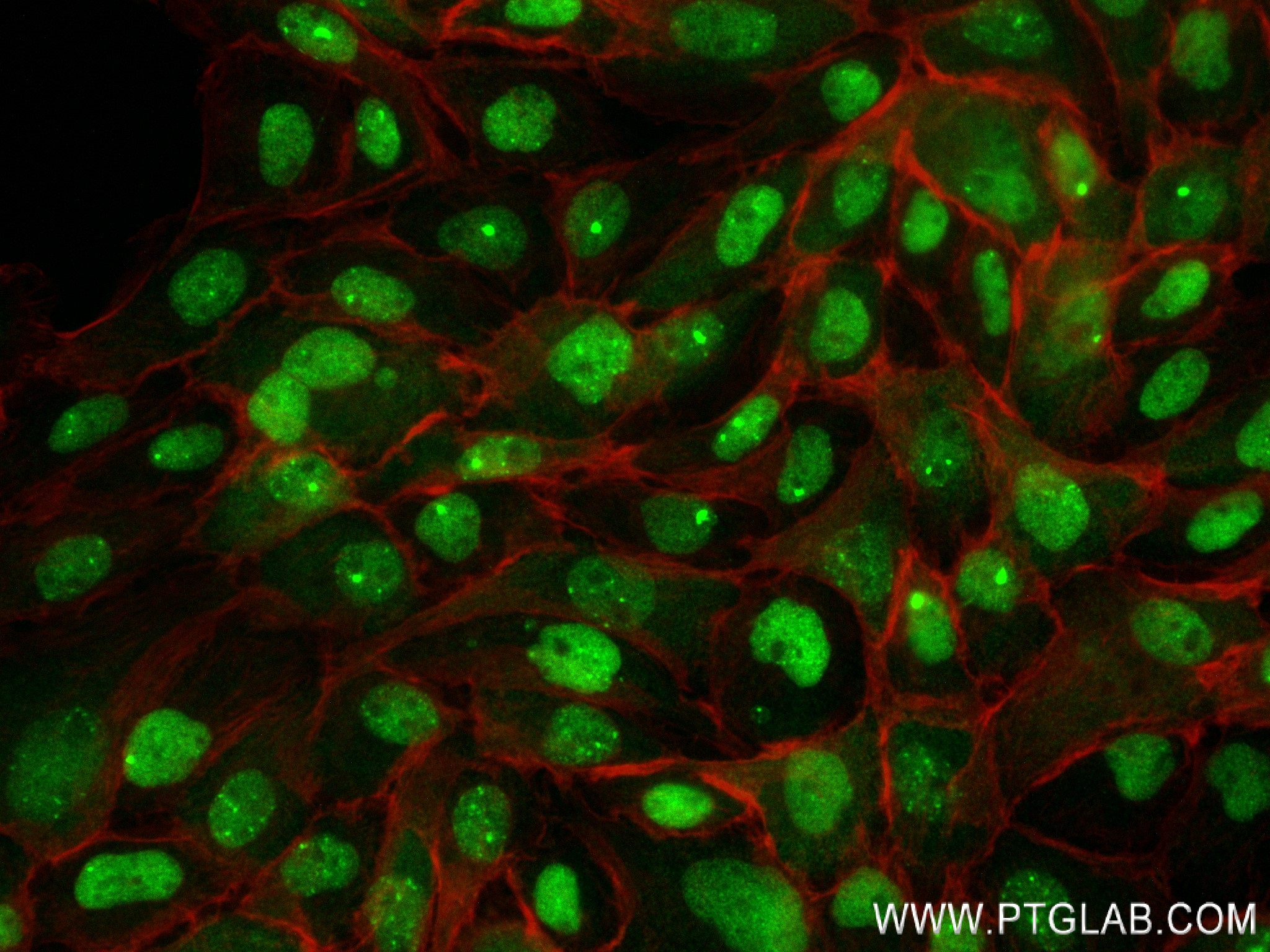 Immunofluorescence (IF) / fluorescent staining of A431 cells using cGAS Recombinant antibody (82869-1-RR)