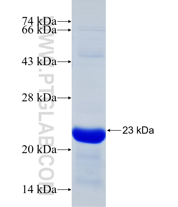 cGAS fusion protein Ag31677 SDS-PAGE