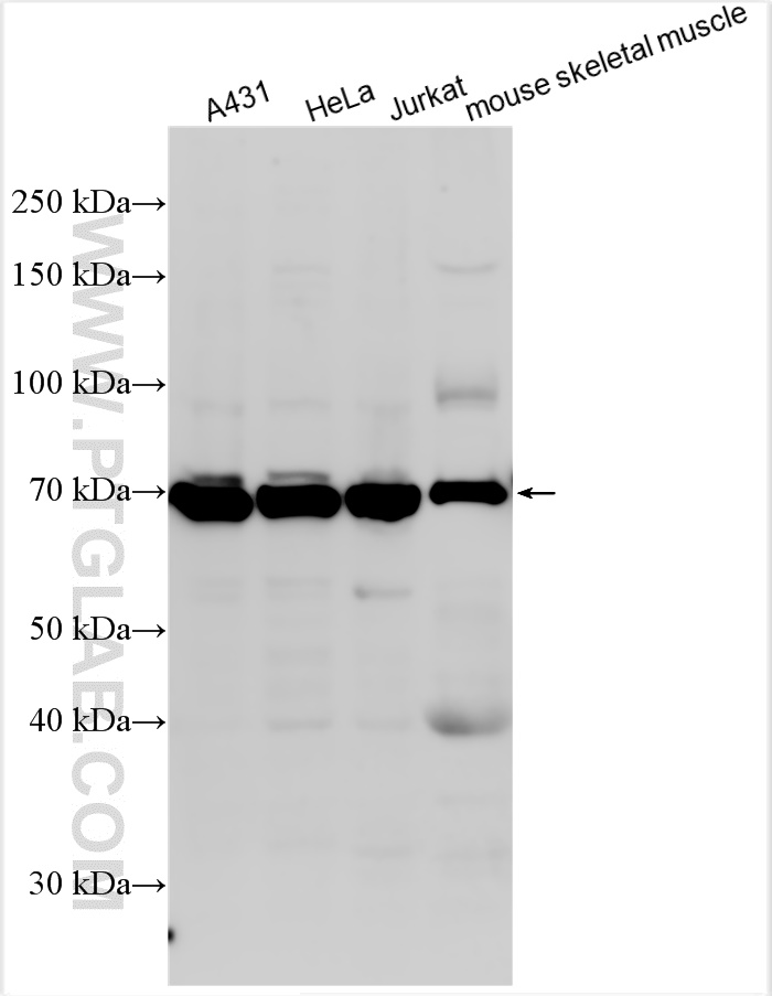 Western Blot (WB) analysis of various lysates using cIAP1 Monoclonal antibody (66626-1-Ig)