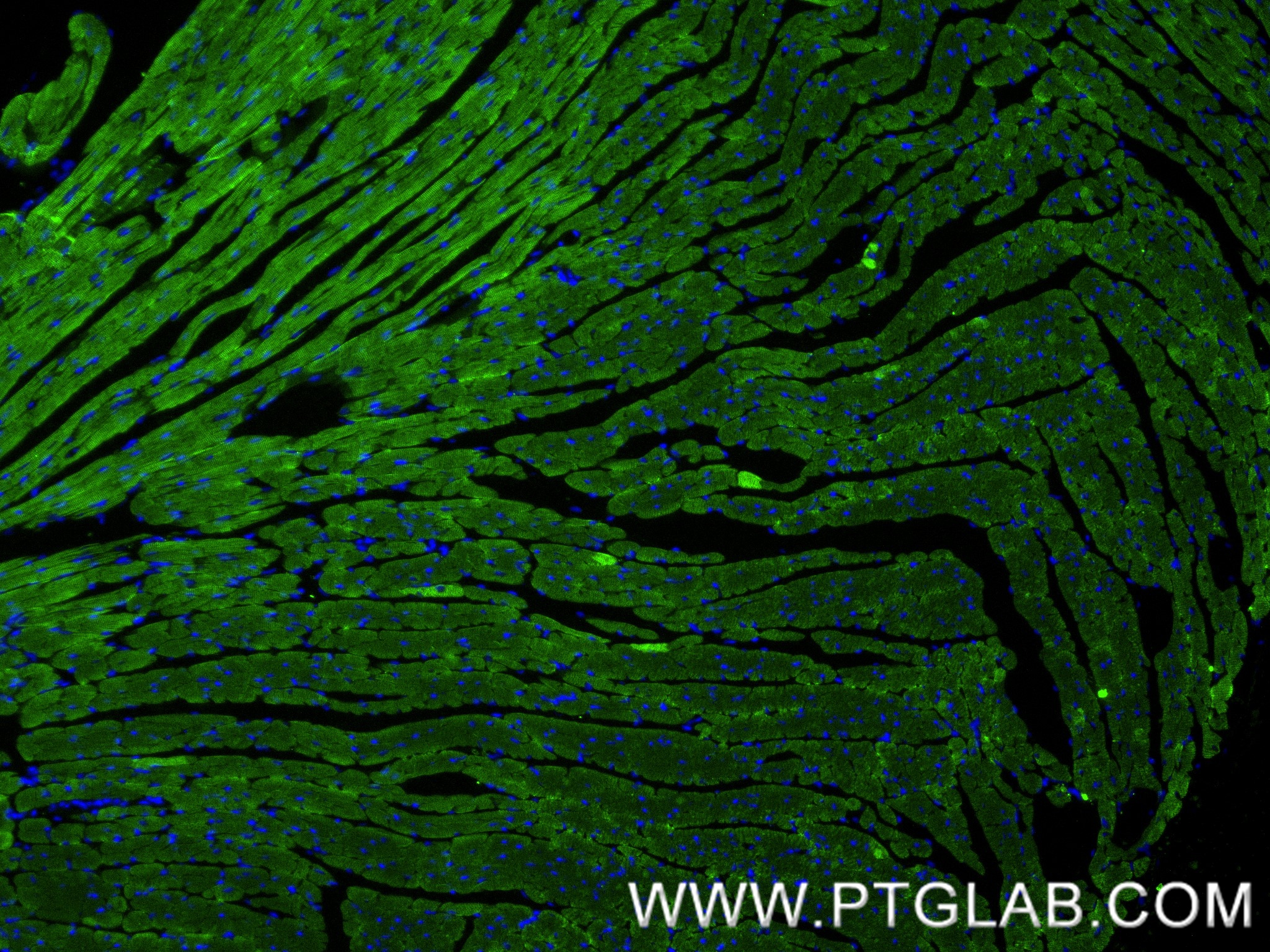 Immunofluorescence (IF) / fluorescent staining of mouse heart tissue using cTnT Recombinant antibody (81638-3-RR)