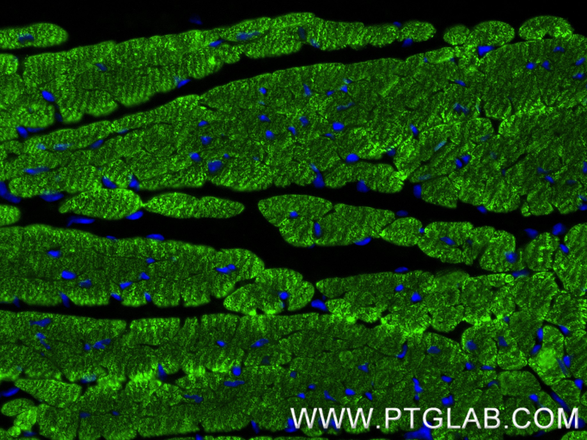 Immunofluorescence (IF) / fluorescent staining of mouse heart tissue using cTnT Recombinant antibody (81638-3-RR)