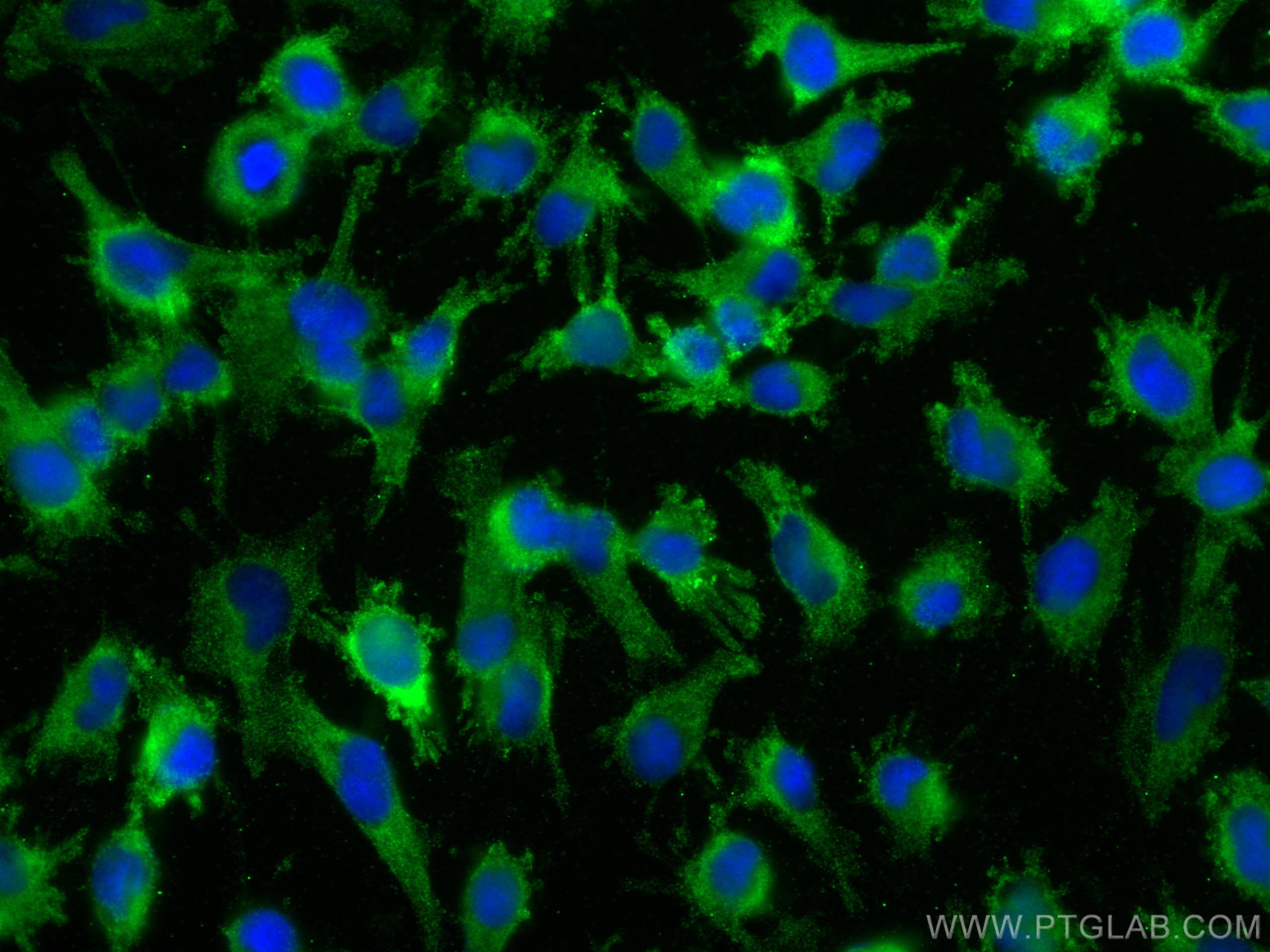 Immunofluorescence (IF) / fluorescent staining of U-251 cells using calcyphosine Monoclonal antibody (68225-1-Ig)