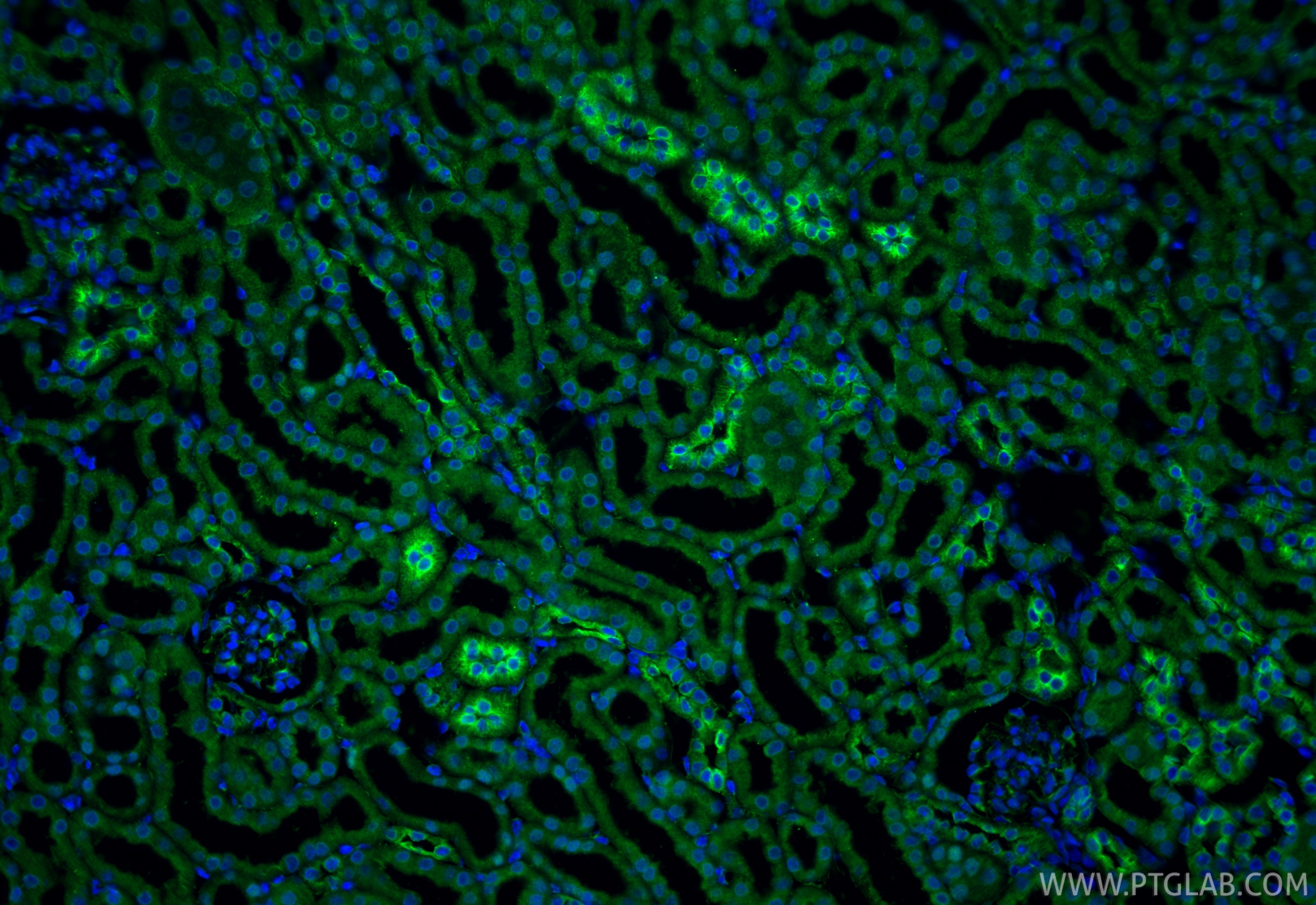Immunofluorescence (IF) / fluorescent staining of mouse kidney tissue using calreticulin Recombinant monoclonal antibody (80017-1-RR)