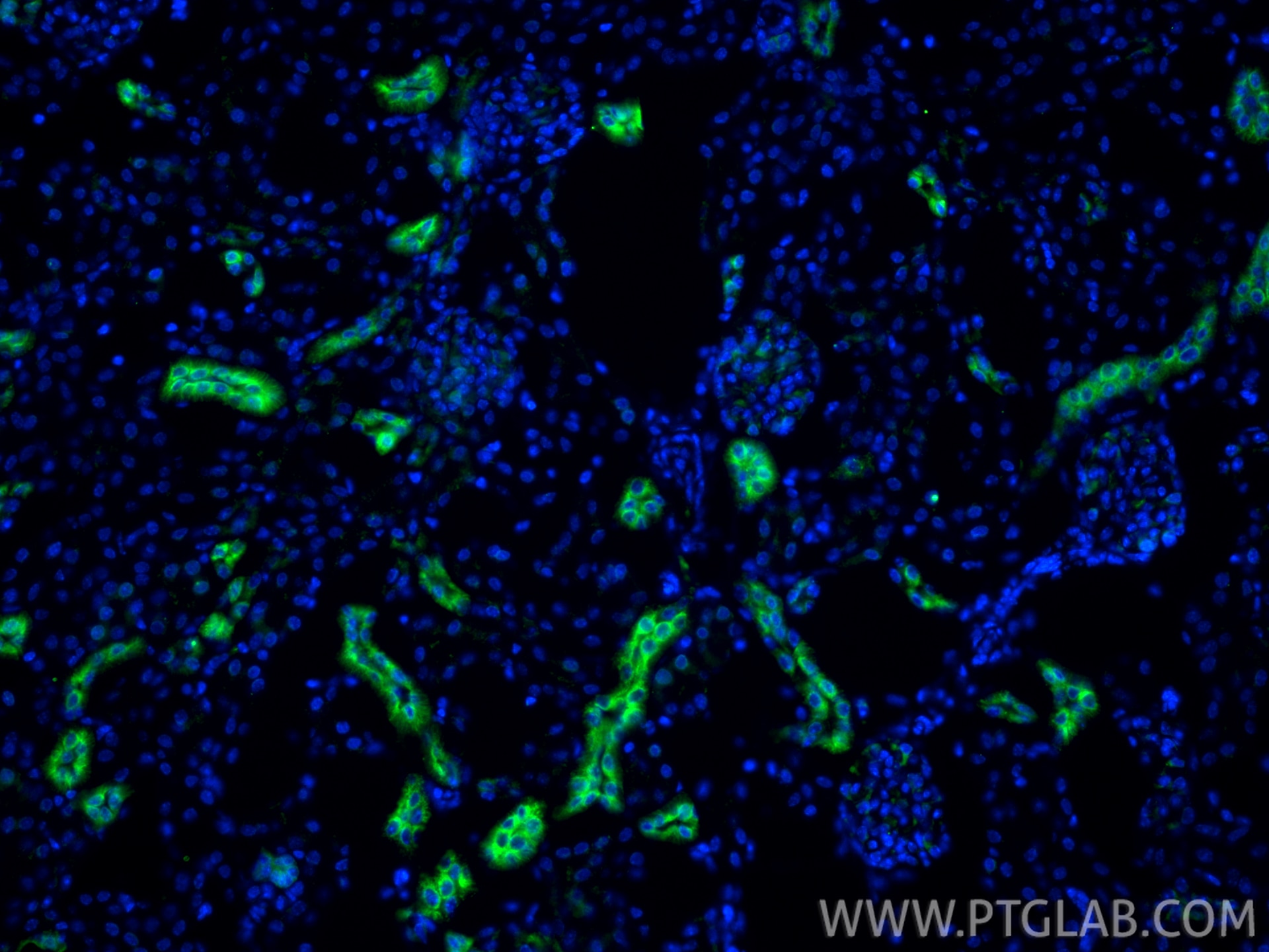 Immunofluorescence (IF) / fluorescent staining of mouse kidney tissue using calreticulin Recombinant monoclonal antibody (80017-1-RR)